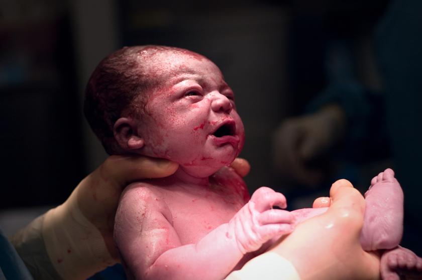 A Baby Born 9 Weeks After His Mom Declared Clinically Dead
