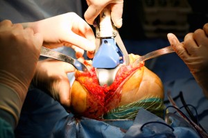 Knee_Surgery_Operation-300x199