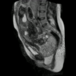 MRI Of Childbirth Shows Miracle Of Life From The Inside Out