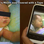 Newborn’s mouth sealed
