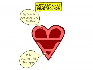 Nursing Mnemonics and Tips: Auscultations of Heart Sounds