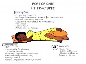 Nursing Care: Post Op Care Hip Fractures