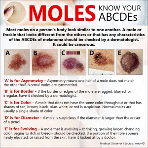 Moles Know Your ABCDEs