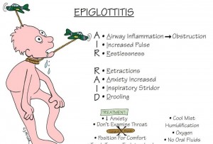 Nursing Mnemonics: Epiglottitis