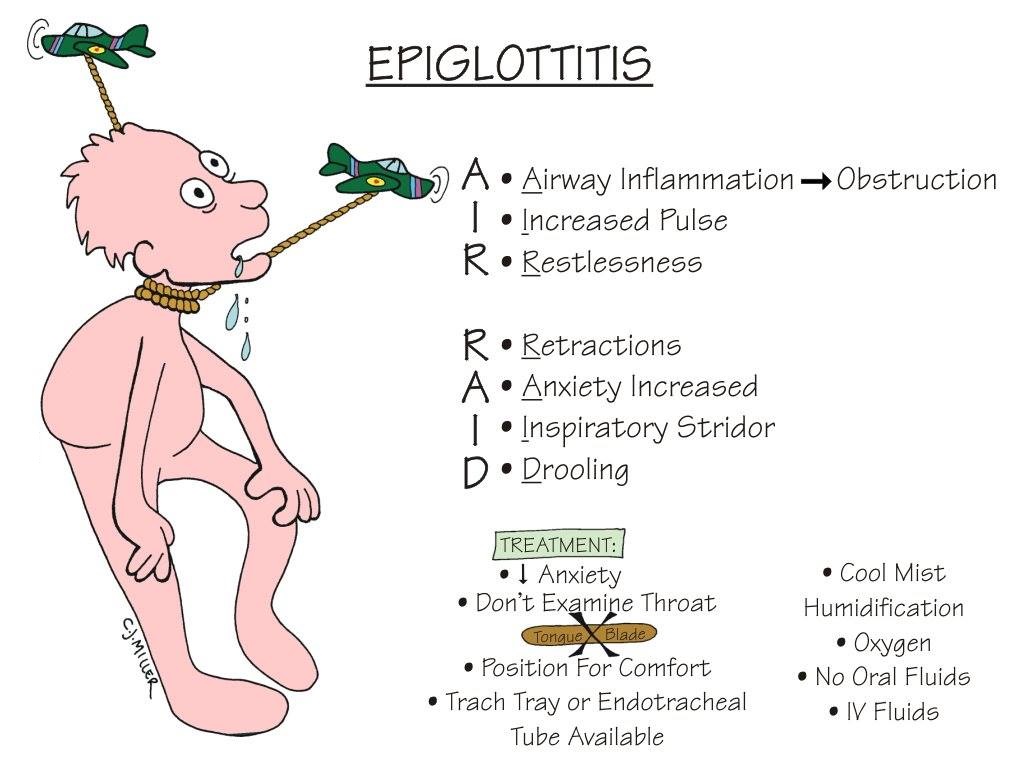 Nursing Mnemonics: Epiglottitis