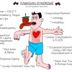 Nursing Mnemonics: Kawasaki Syndrome