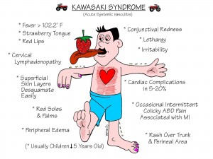 Nursing Mnemonics: Kawasaki Syndrome