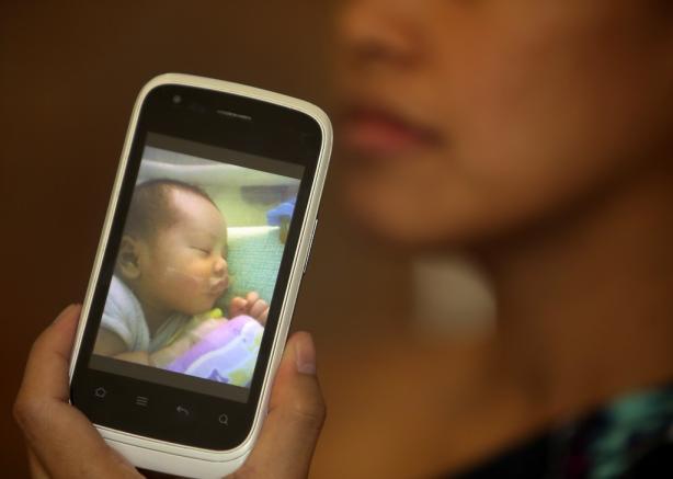 Newborn’s mouth sealed