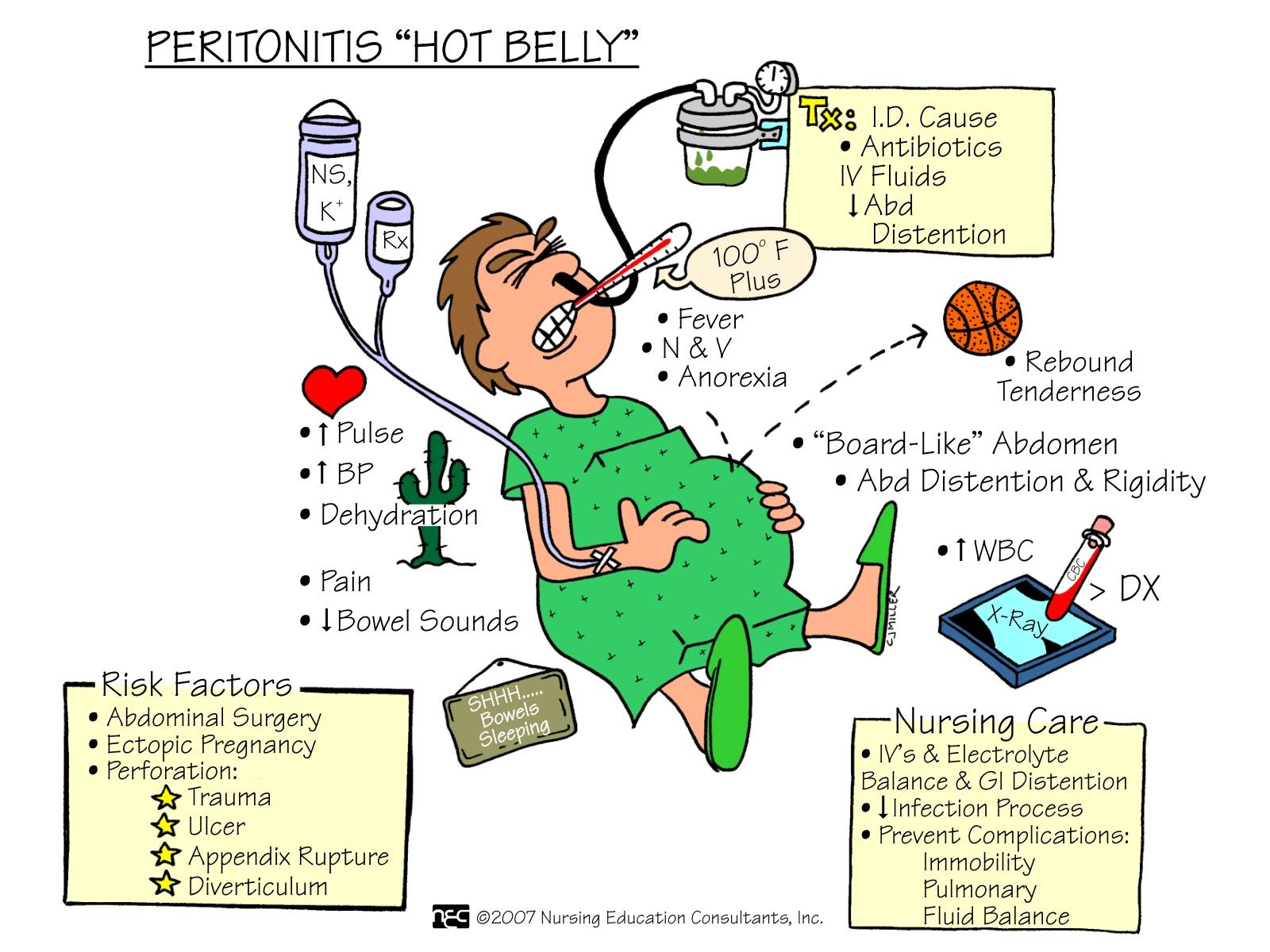 Nursing Mnemonics: Peritonitis "Hot Belly"