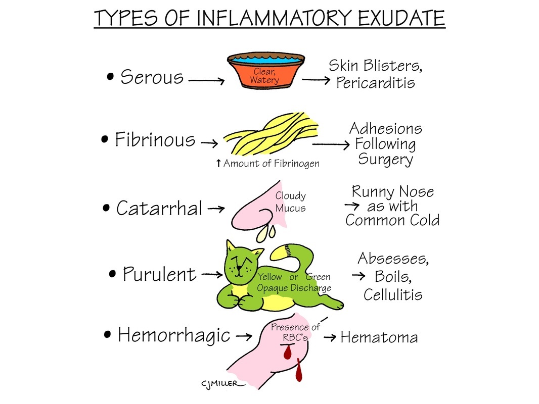 Nursing Study: Types of Inflammatory Exudate - StudyPK