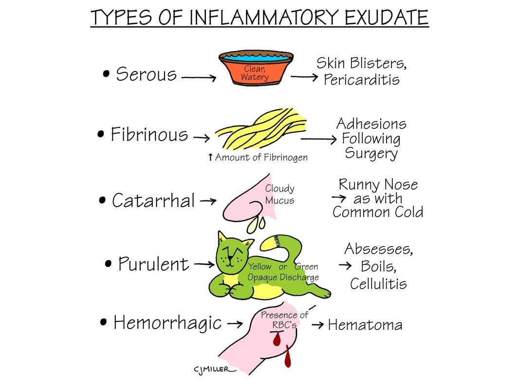 Nursing Study: Types of Inflammatory Exudate