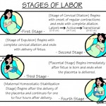Nursing Guide: The Four Stages of Labor