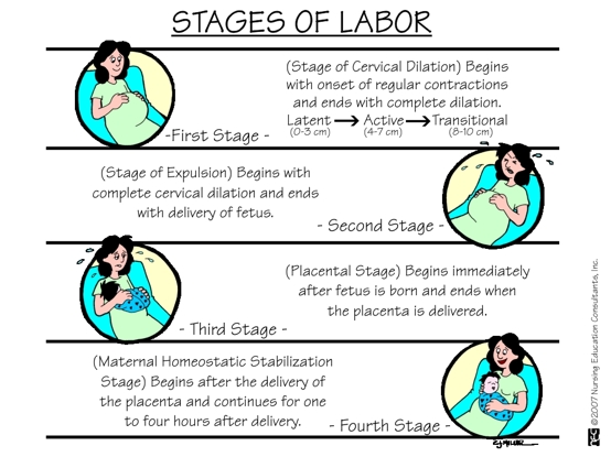 Nursing Guide: The Four Stages of Labor