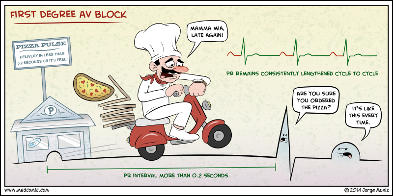 Nursing Study: First Degree Heart Block