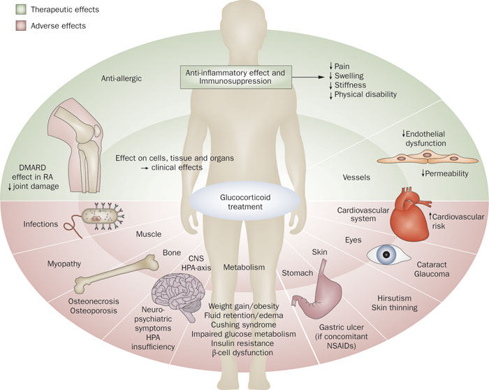 Adverse effects of Glucocorticoids