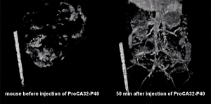 Protein-Based MRI Contrast Agent Enhances Liver Cancer Detection