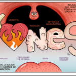 Nursing Guide: Rheumatic Fever