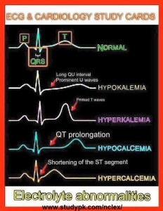 ECG & Cardiology Study Cards: Electrolyte Abnormalities