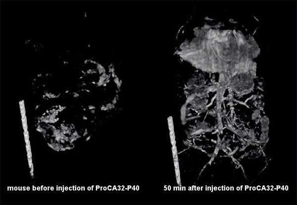 Protein-Based MRI Contrast Agent Enhances Liver Cancer Detection