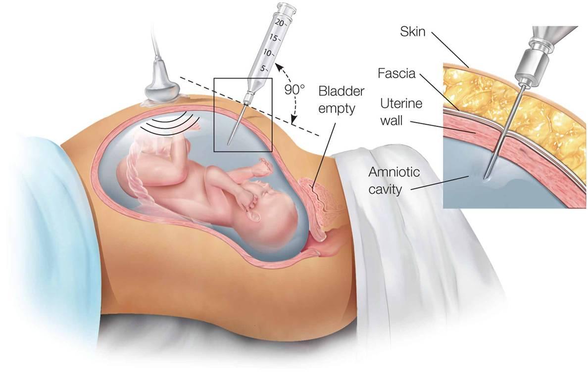 NCLEX SATA Practice Questions: Quiz 61
