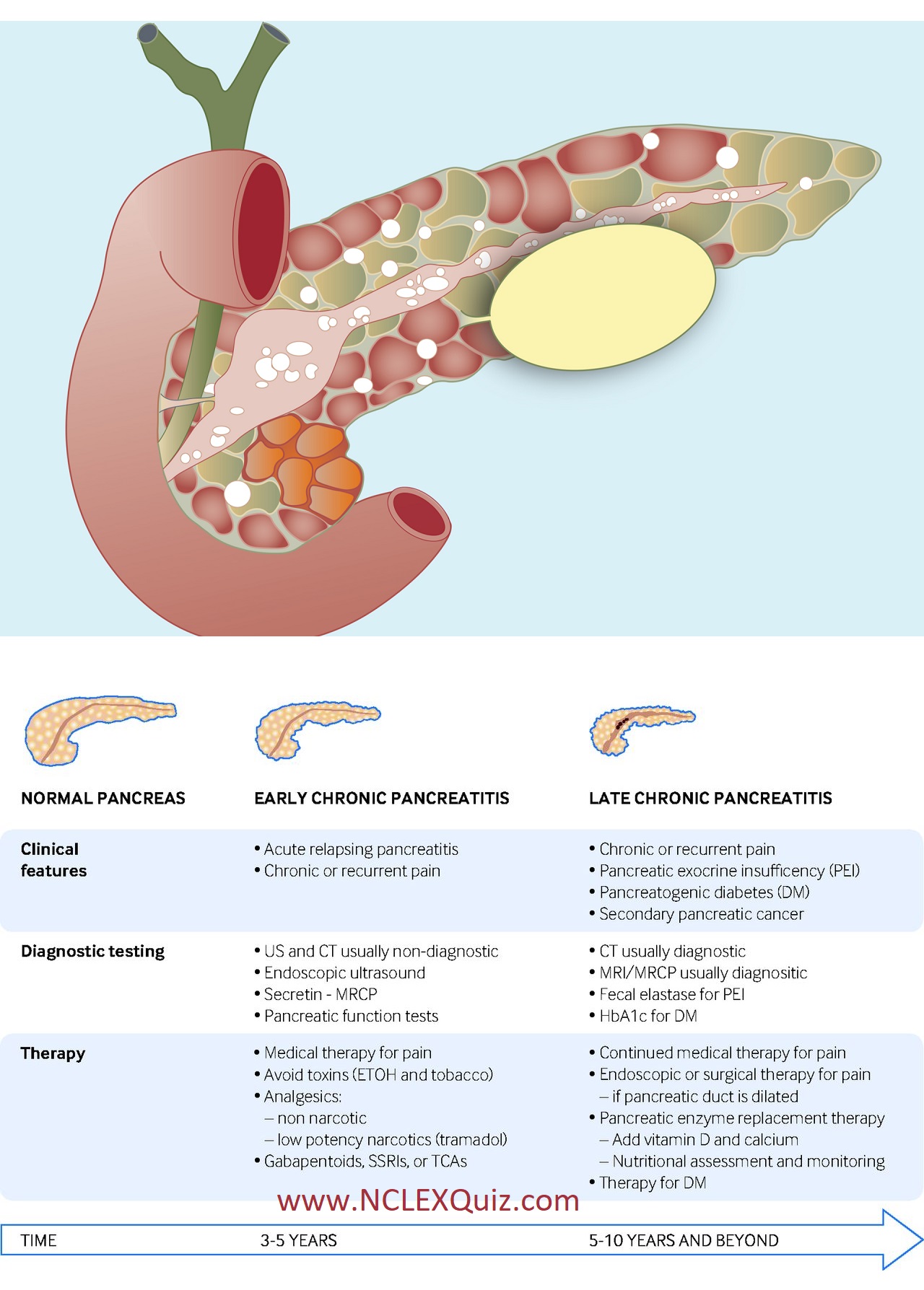 NCLEX Practice Questions: Chronic Pancreatitis Teaching