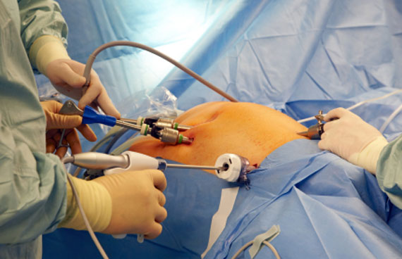 NCLEX Practice Questions: Quiz 177