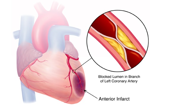 NCLEX Review Questions: Quiz 27