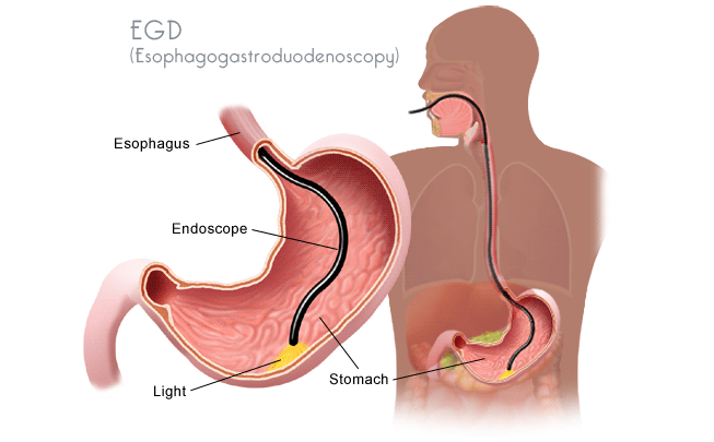 NCLEX Practice Questions: Quiz 137