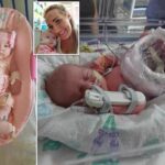 NCLEX Practice Questions Quiz 170