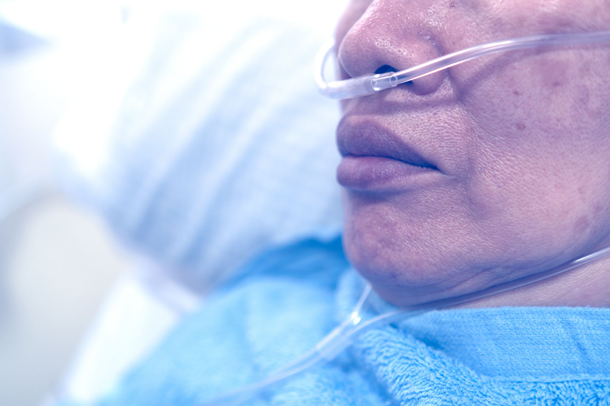 Critical NCLEX Practice: Responding to a Client in Choking Emergency