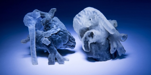 MIT Converts MRI Scans into Highly Accurate 3D-Printed Models