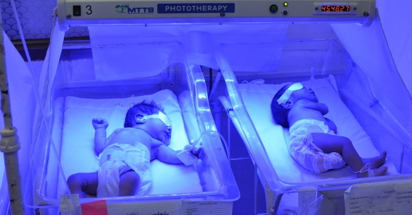 phototherapy neonatal