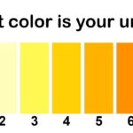 Mahogany Urine in Burned Client: Identifying the Cause with NCLEX Practice Quiz