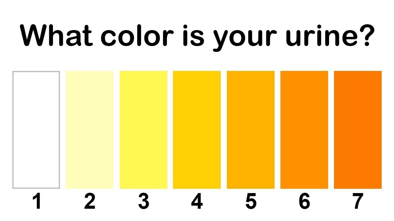 Mahogany Urine in Burned Client: Identifying the Cause with NCLEX Practice Quiz