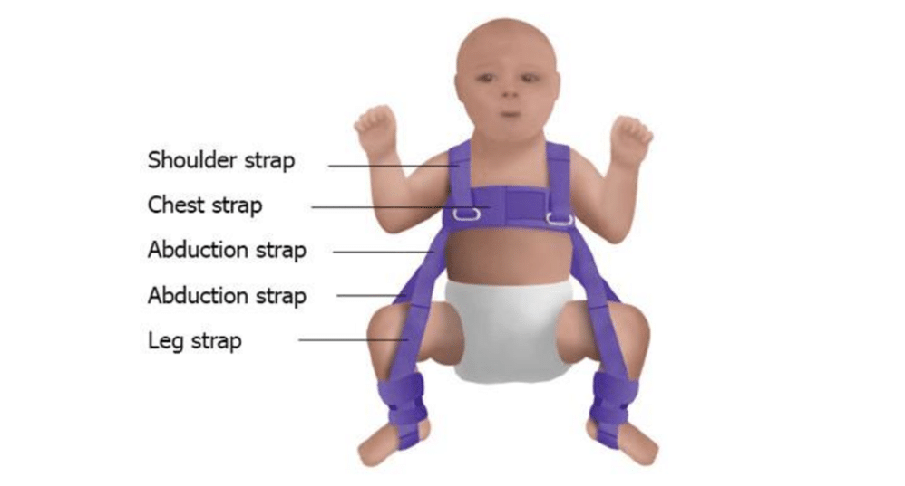 The Parents' Guide to caring for a child in a Pavlik harness