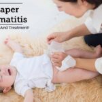 Which of the following measures would be appropriate for the nurse to teach the parent of a nine month-old infant about diaper dermatitis