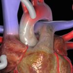 NCLEX Practice Questions: Quiz 470