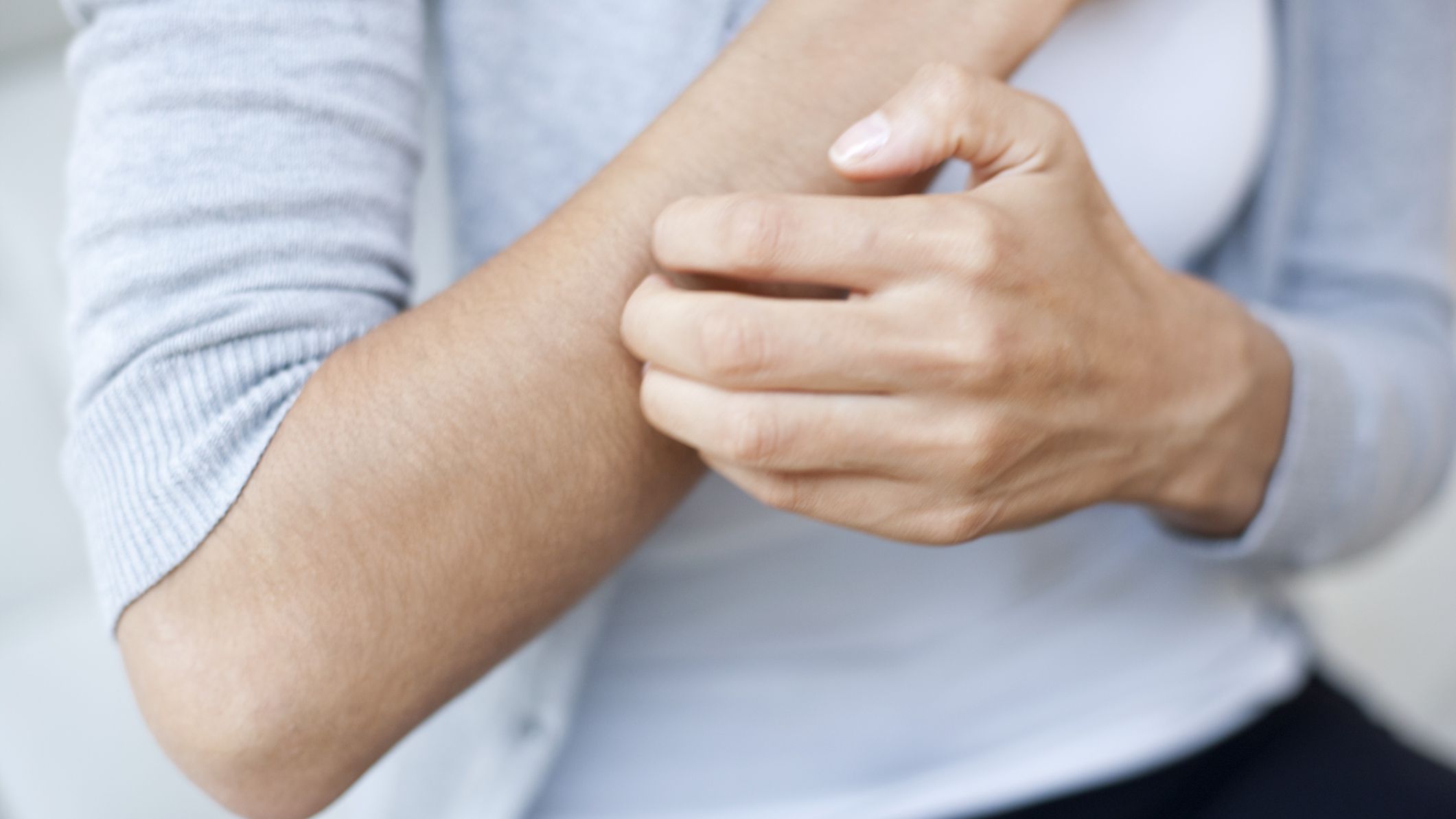 classic skin condition associated with Still disease