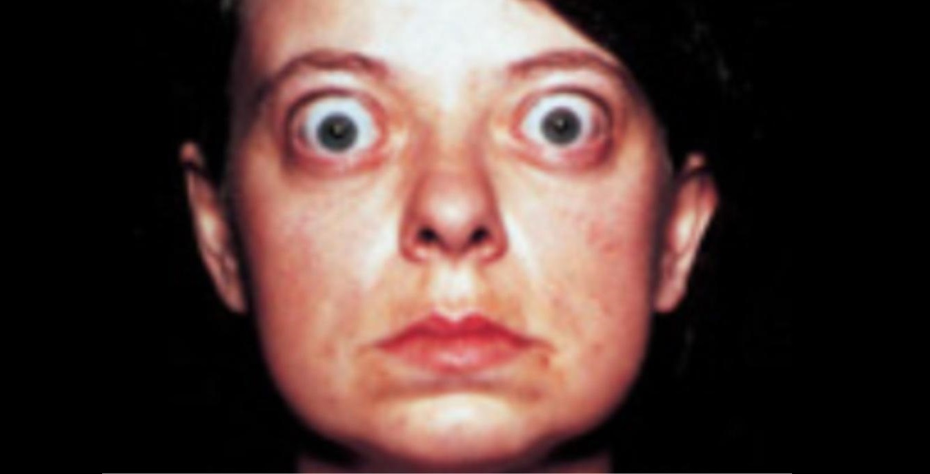 NCLEX Practice Questions Quiz 532 StudyPK