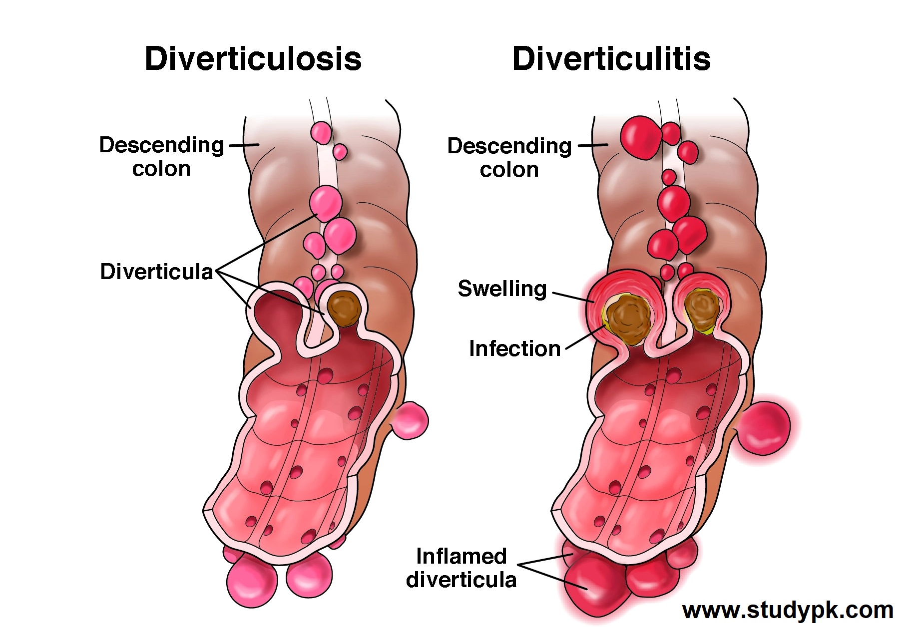 NCLEX-RN Exam Practice Questions: Quiz 658