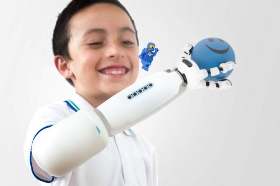 Prosthetic hand design wins prize