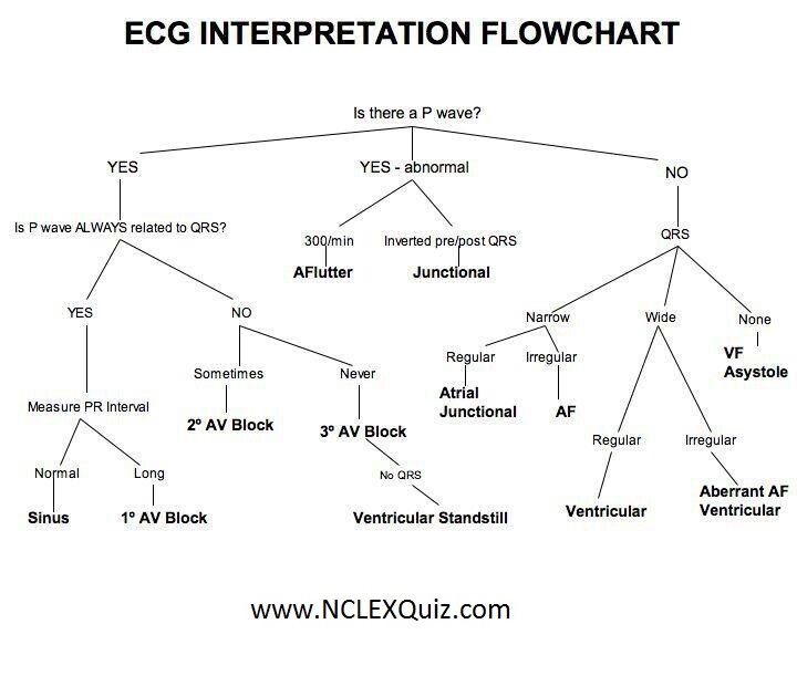 EKG Interpretation Flowchart