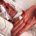 Top 5 Challenges Of A Respiratory Therapist