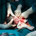 C-Sections: The Easy Way Out