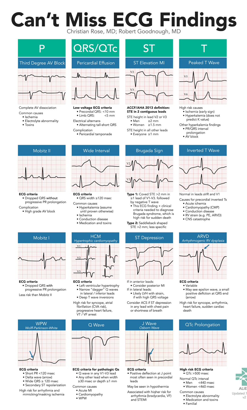 Can’t Miss ECG Findings Cards for the Emergency Medicine Provider
