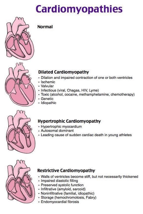 Cardiomyopathy Types Mnemonics Cheat Sheets for Nursing Students