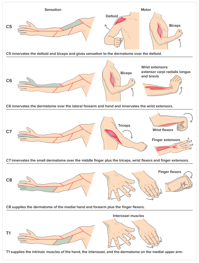 C5 C6 Cervical Radiculopathy (Pinched Nerve) Stretches & Exercises