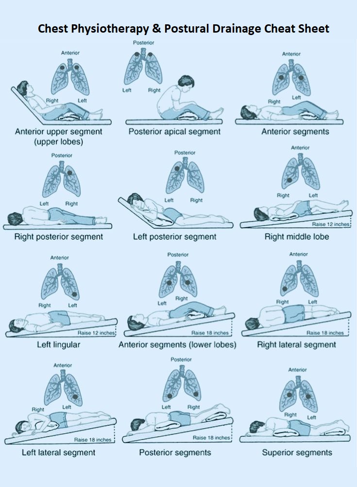 Postural Drainage Chest Physiotherapy