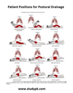 Cardiopulmonary Assessment & Intervention: Patient Positions for Postural Drainage