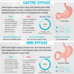 Bariatric Surgery Comparison Infographic What is the best weight loss surgery